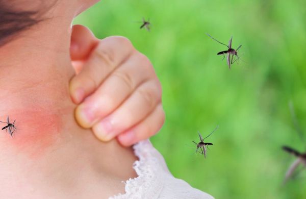 Mückenstiche behandeln Gesundheit Tipps